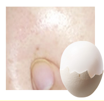 卵殻膜